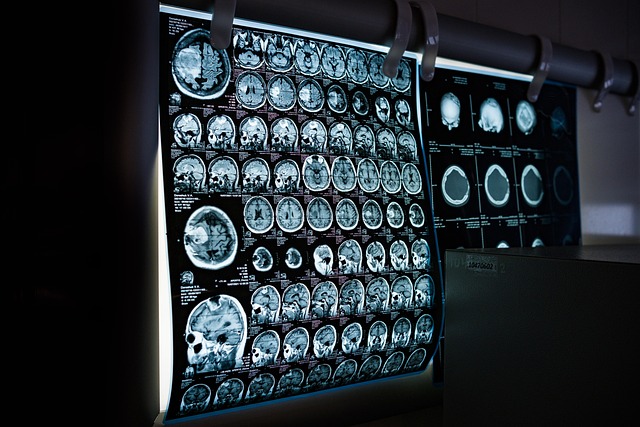 Advanced diagnostic imaging